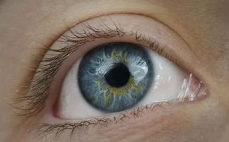眼屎也能辨别疾病,眼屎异常,小心这几种眼病