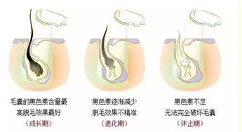 脱毛知识