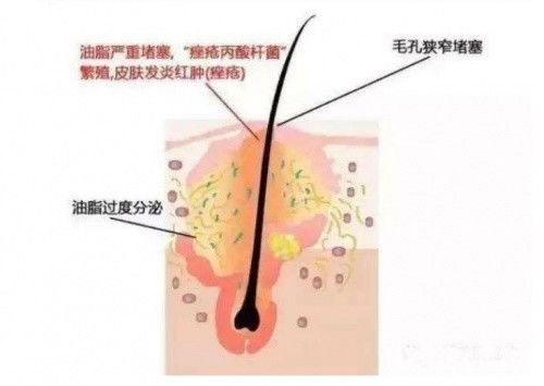 天秤座女生分手后表现形式 天秤座分手后的表现和心理分析