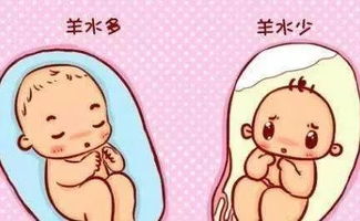 孕妈妈如何面对羊水异常