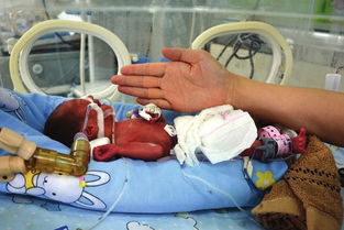 泰国做婴儿试管,奇迹：实现家庭梦想，创造生命奇迹