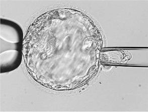 试管复苏囊胚的过程,试管复苏囊胚：孕育新生命的希望之旅