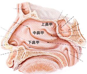 暨南大学崇爱医院耳鼻喉专科唐佰才医师讲解鼻甲肥大的治疗