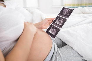 原创孕28周后，胎儿容易出现这几种问题，孕妈别大意！