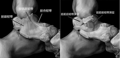 脚踝韧带断裂怎样恢复(脚踝韧带断了怎么办恢复快)