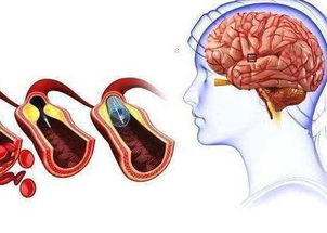 血管该怎么养 记住4个字,常食3红 多饮2水,养好血管人不老 