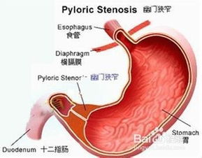 肚子胀气是因为什么原因