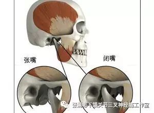 怎么确定下颌骨错位了,下颌骨错位是一种