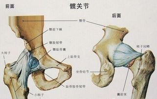 髋关节疼痛治疗方法