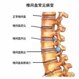 st板块中可能重组的有哪些？