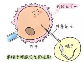广东试管婴儿- 打破生育难题，开启幸福人生！