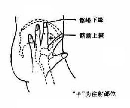 没加密的打针injection,最新研究表明:注射ijecio对疾病的预防和治疗有重要作用