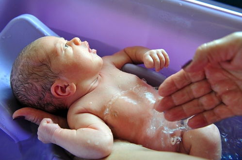 新生宝宝脱皮,原因有二,洗澡时最好注意五点,附宝宝洗澡顺序