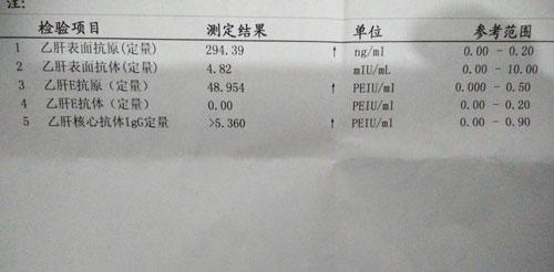 眼睛巩膜发黄,慢性乙肝早期表现,核苷类药物使用要规范