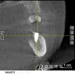  德国icx种植系统 钱包应用