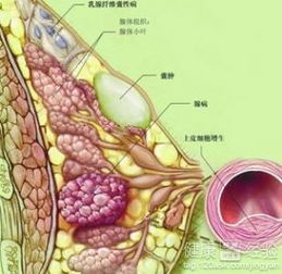 乳腺肿瘤切除手术步骤有哪些(乳腺肿瘤切除手术需要多长时间)