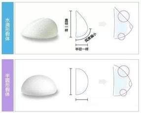 极立ftm假体,什么是极化效果?