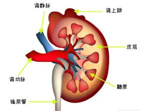 肾病综合征4年,面部下肢水肿这样治效果不错 