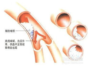 医院怎么检查耳朵听力,医院检查耳朵听力