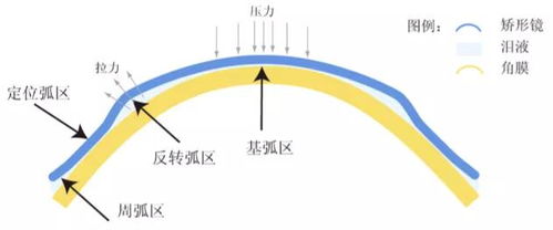 ok镜是收 智商税 吗