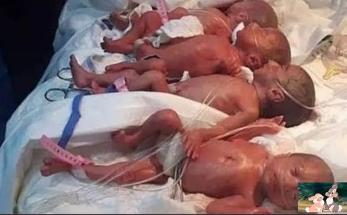 25岁非洲妈妈生下9胞胎,母婴全部存活,丈夫感激上苍不惧未来