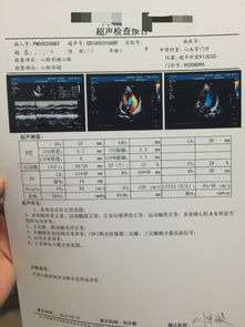 请帮看一下心脏彩超报告，心功能如何