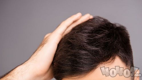成人每天掉多少头发是正常的(脱发怎么办？食疗还是植发？)