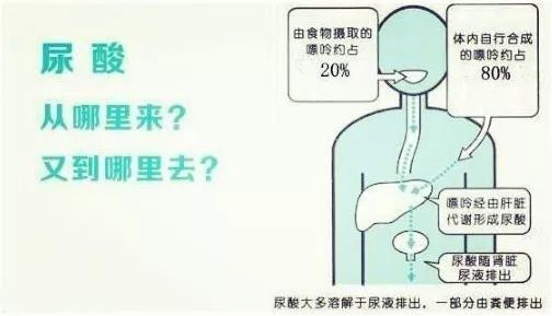 体检发现尿酸偏高,为啥有人痛风发作 有人却无症状