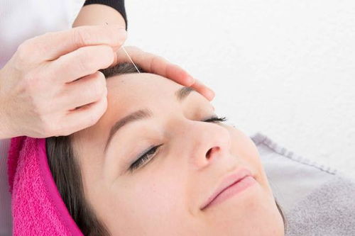 偏头痛发作时,建议这5个方法,或能快速改善,不妨了解一下
