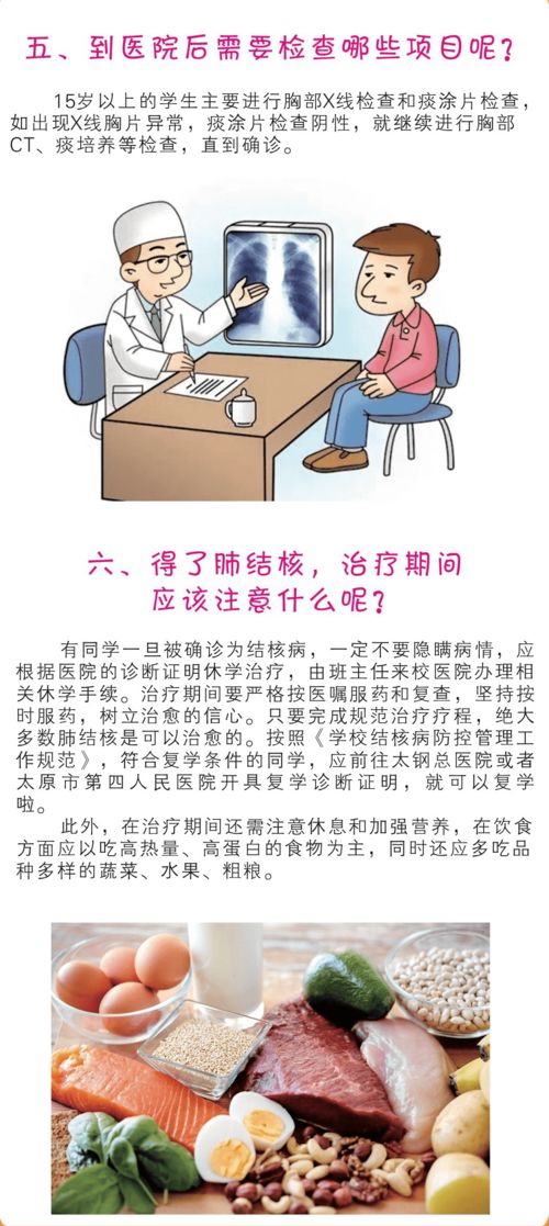 肺结核必知常识