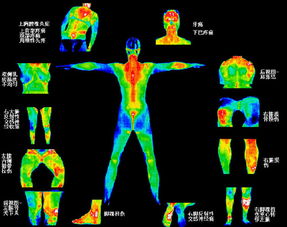 体检全身红外热成像多少钱