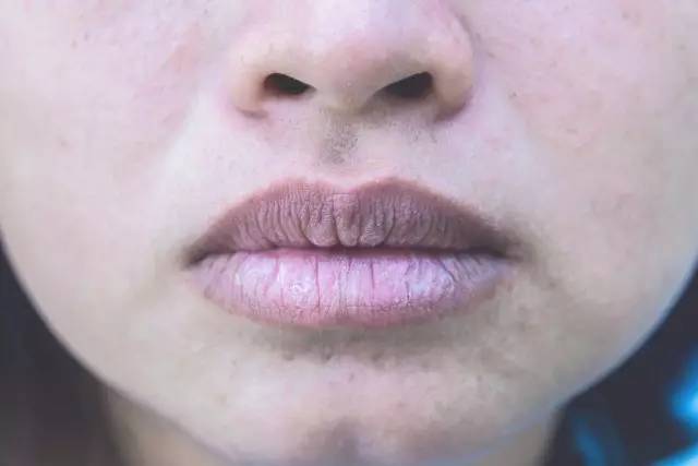 女人嘴唇发紫图片图片