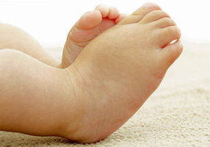 孕晚期脚肿怎么缓解？