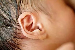 婴儿中耳炎会自愈吗 中耳炎耳朵闷能自愈么？ 