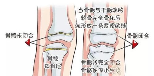 总是担心孩子长不高 但你知道孩子是如何长高的吗