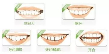 牙齿畸形的常见类型
