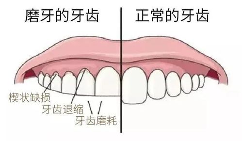 嘴里有只 滑板鞋 ,磨牙应该这么做...