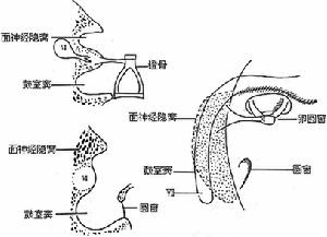 中耳炎有哪些类型