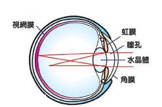 散光度数增加怎么办