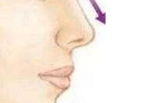鼻咽癌早期症状(鼻咽癌早期症状 10种症状)