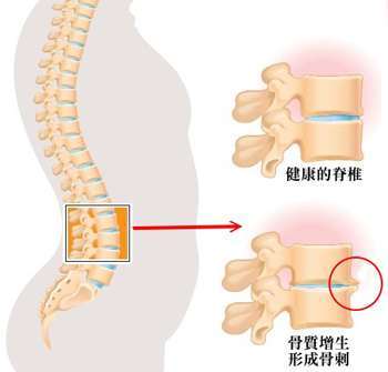 肺癌患者每天晚上低烧37度左右是什么原因?