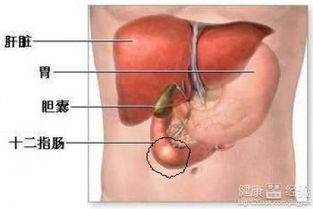 胆囊炎不能吃什么食物,胆囊炎患者应避免的食物