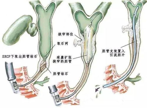 7分钟,98岁老人化险为夷