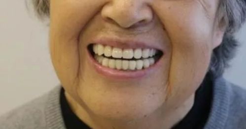 牙齿不好,往往与3个因素相关,趁早改正,或能保护牙健康