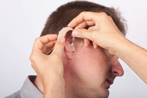 单耳佩戴助听器后出现听觉剥夺 什么是听觉剥夺 如何预防