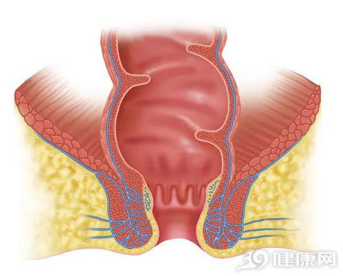 奇妙的中医 小小痔疮,中医竟有这么多对付它的方法