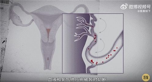 女性痛经是因为前列腺素 多喝热水并不顶用 