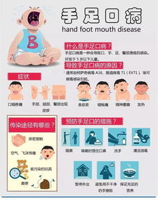 手足口 疱疹性咽峡炎 预防方法 
