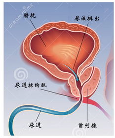 前列腺增生介绍和表现