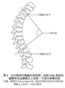 舒张性心力衰竭不能吃什么 